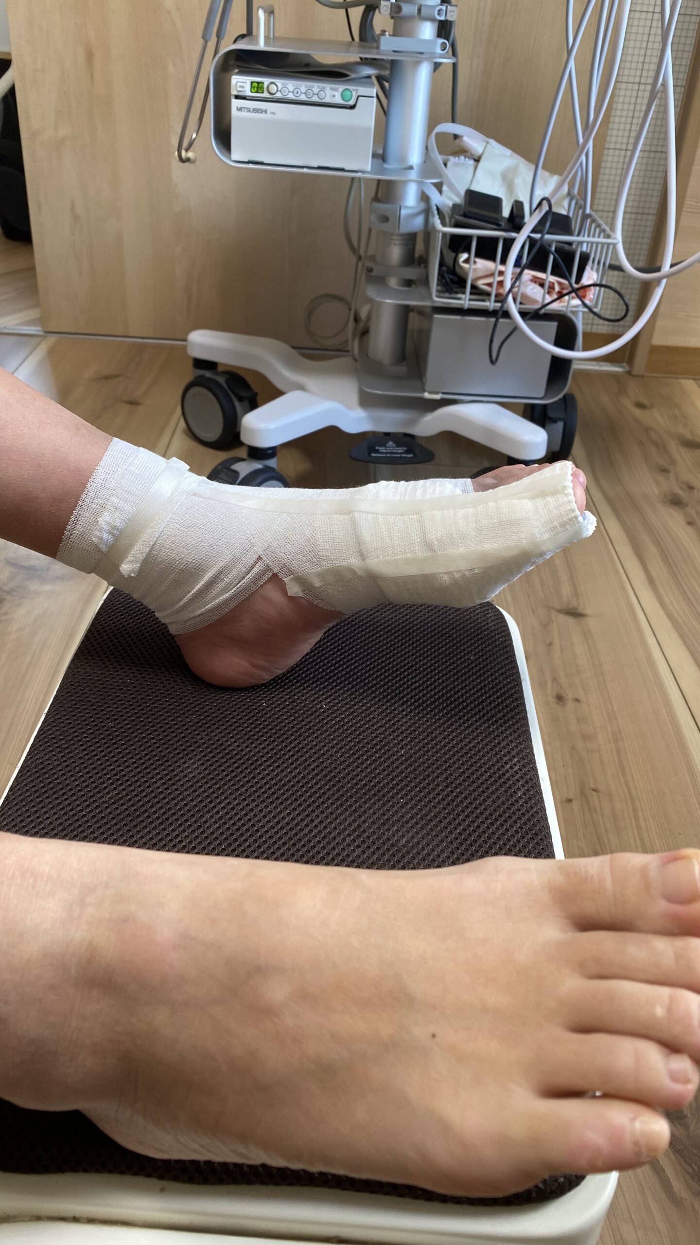 骨折後３週間でマラソンを走れるのか？① 画像